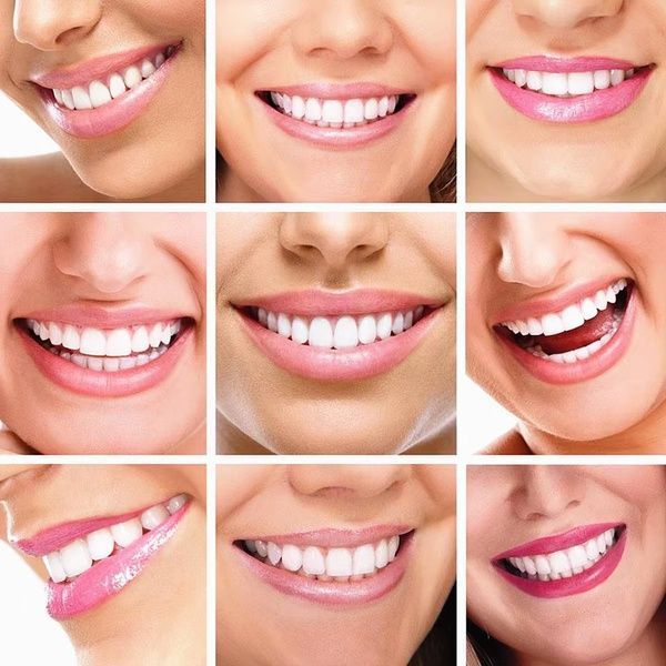 Система відбілювання зубів Dental White: сяюча посмішка без зусиль. / LED відбілювання зубів / Засіб для відбілювання зубів 234578491 фото