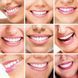 Система відбілювання зубів Dental White: сяюча посмішка без зусиль. / LED відбілювання зубів / Засіб для відбілювання зубів 234578491 фото 3